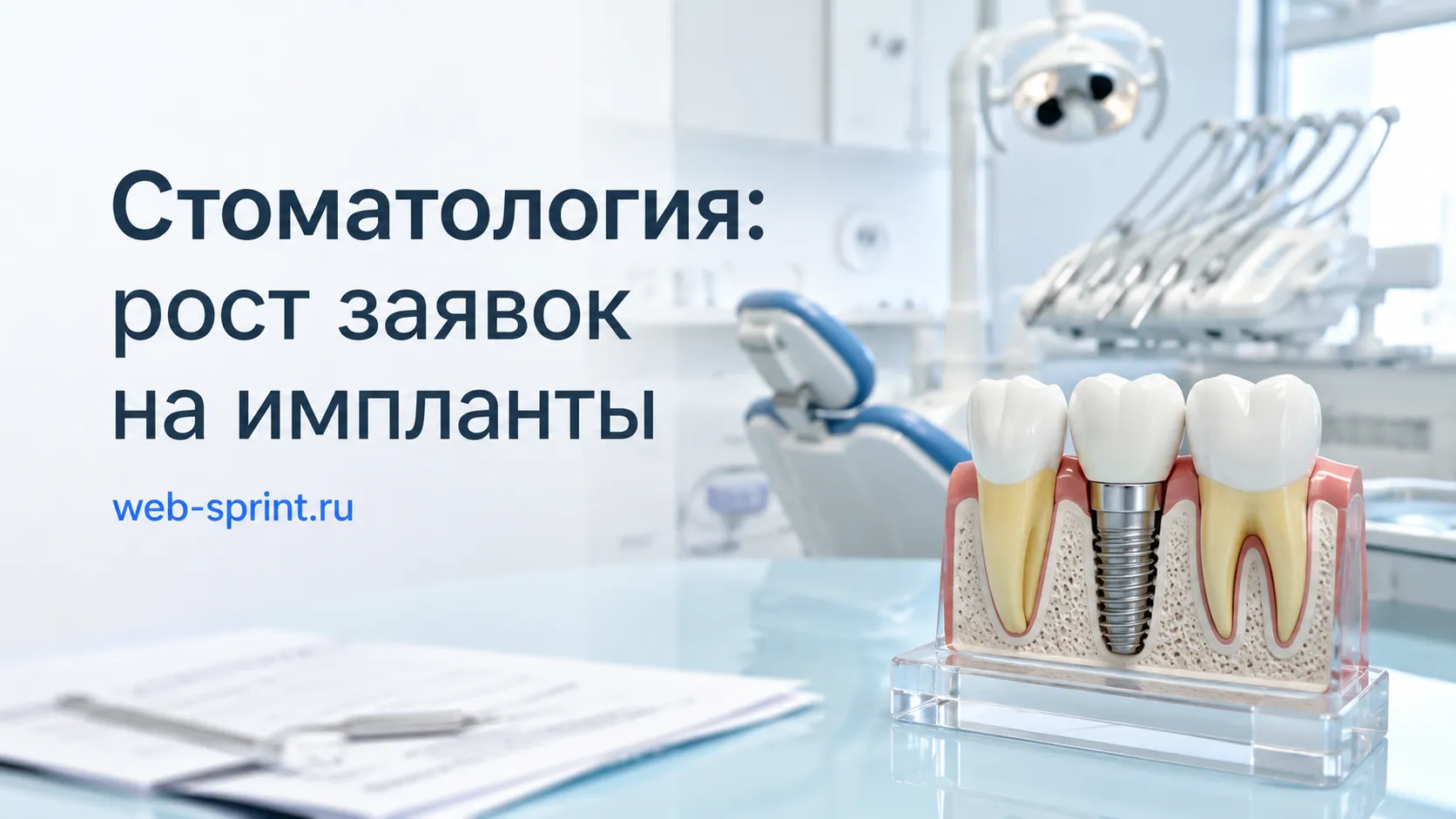 Стоматология: рост заявок на импланты